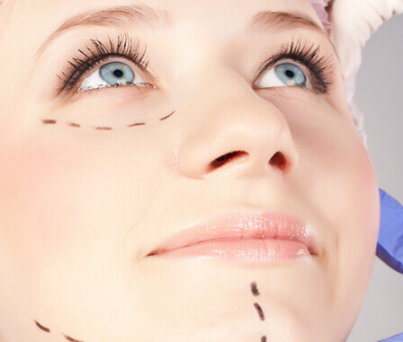 Young woman with face marked up for plastic surgery